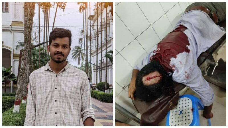 বিসিএস পরীক্ষা পেছানোর দাবিতে কর্মসূচি: পুলিশের হামলায় গুরুতর আহত বুটেক্স শিক্ষার্থী শাহিনুর