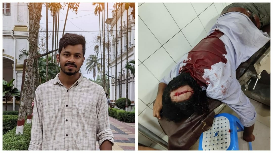 বিসিএস পরীক্ষা পেছানোর দাবিতে কর্মসূচি: পুলিশের হামলায় গুরুতর আহত বুটেক্স শিক্ষার্থী শাহিনুর